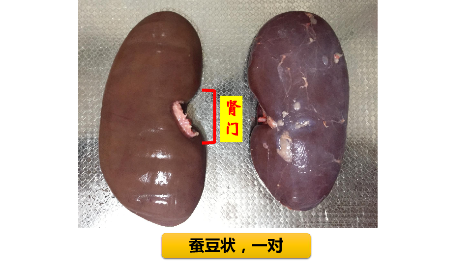 人教版生物七年级下册第四单元第五章人体内废物的排出课件共32张ppt