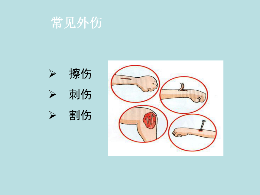 32割伤刺伤擦伤课件20212022学年体育与健康五至六年级人教版共13张