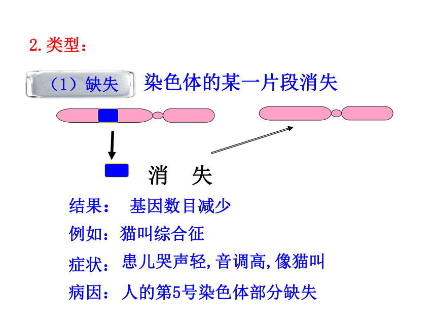 失例如:猫叫综合征基因数