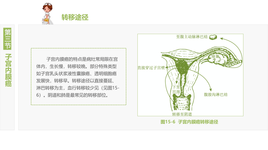 15.3子宫内膜癌 课件(共21张PPT)-《妇产科护理》同步教学（江苏大学出版社）
