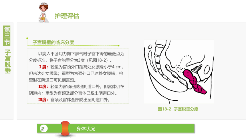 18.3子宫脱垂 课件(共18张PPT)-《妇产科护理》同步教学（江苏大学出版社）