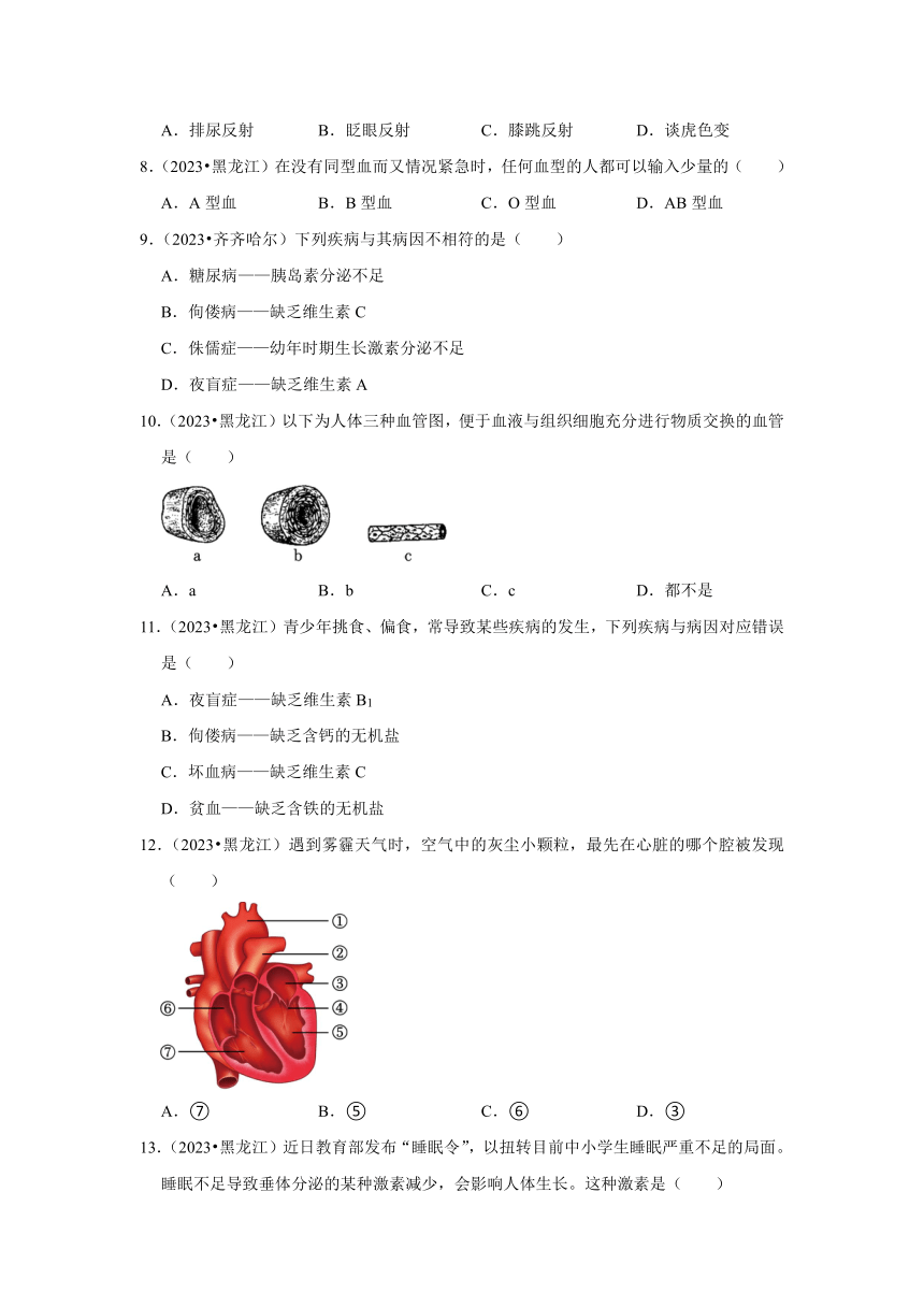 专题4人体系统——2022-2023年黑龙江省中考生物试题分类（含解析）