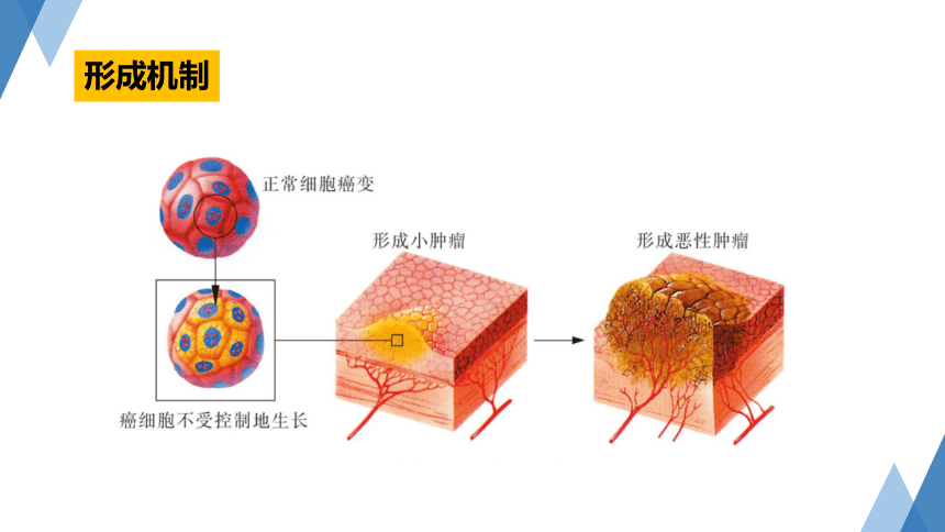 3.4 非传染性疾病 —2023-2024学年浙教版科学九年级下册（课件 23张ppt）