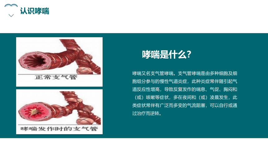 哮喘健康教育课件(共25张PPT)