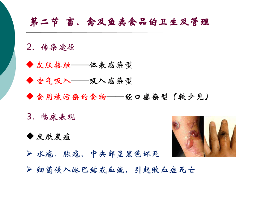 11各类食品卫生及其管理-2 课件(共47张PPT)- 《营养与食品卫生学》同步教学（人卫版·第7版）