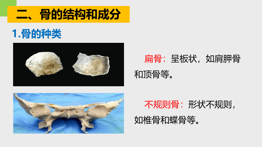 3.5人体的运动系统和保健 —2023-2024学年浙教版科学九年级下册（课件 32张ppt）