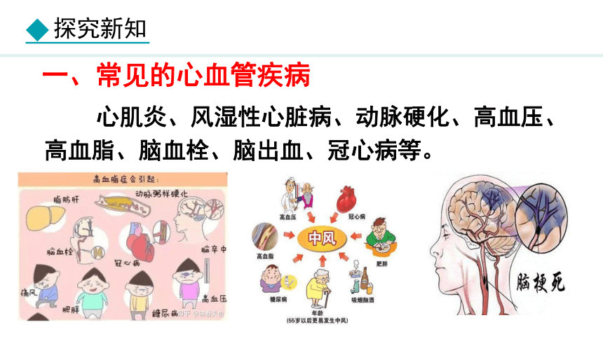 2.2.4心脏和血管的保护课件（13张PPT)冀少版七年级下册