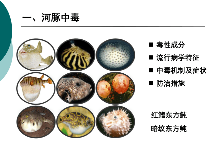 12食源性疾病及其预防-2 课件(共33张PPT)- 《营养与食品卫生学》同步教学（人卫版·第7版）