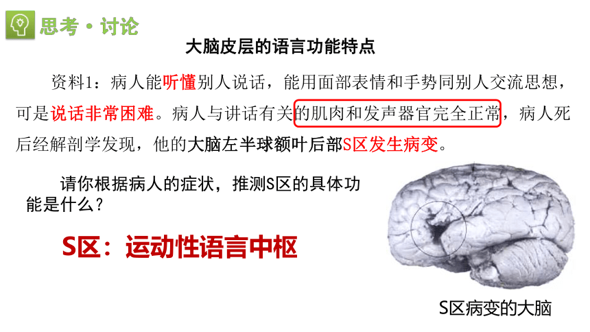 2.5人脑的高级功能课件-(共22张PPT1份视频)人教版（2019）选择性必修1