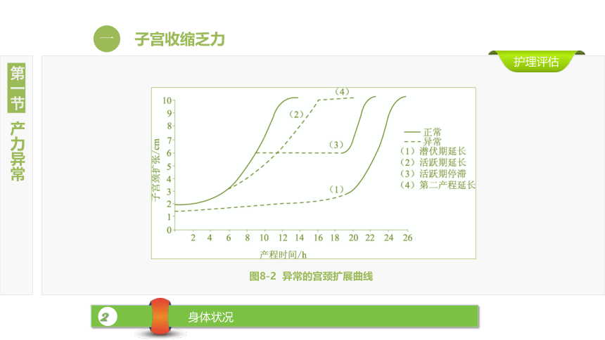 8.1产力异常 课件(共33张PPT)-《妇产科护理》同步教学（江苏大学出版社）