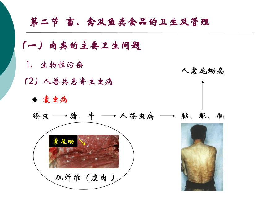 11各类食品卫生及其管理-2 课件(共47张PPT)- 《营养与食品卫生学》同步教学（人卫版·第7版）