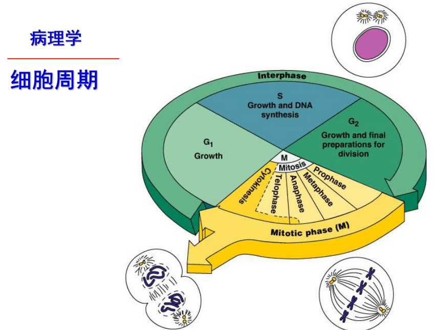 第1章 细胞和组织的适应、损伤与修复3 课件(共27张PPT)-《病理学·第4版》同步教学（科学出版社）