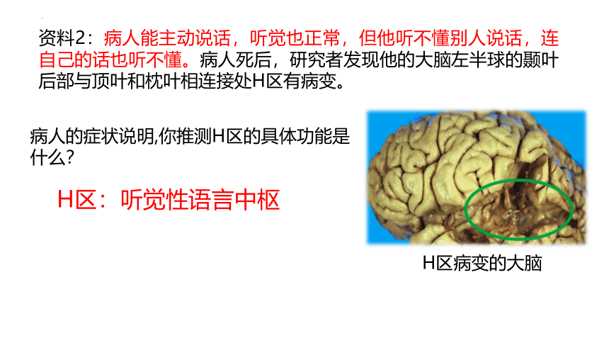 生物人教版2019选择性必修1 2.5 人脑的高级功能（共22张ppt）