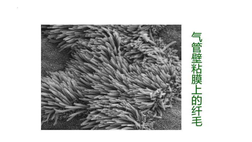 4.13.3 人体免疫课件 (共27张PPT)北师大版生物七年级下册