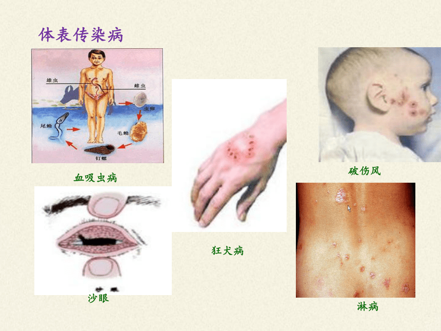 苏教版生物八年级下册 第25章 第一节 传染病课件(共24张PPT)