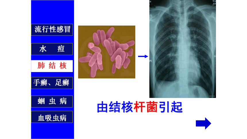 8.1.1+传染病及其预防-2022-2023学年八年级生物下册同步备课优质课件（人教版）(共44张PPT)