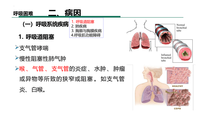 第一篇 常见症状 呼吸困难课件(共55张PPT)《诊断学基础》同步教学（人卫版）