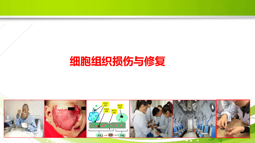 1.1细胞和组织的适应 课件(共21张PPT)《病理学》同步教学（人卫版）