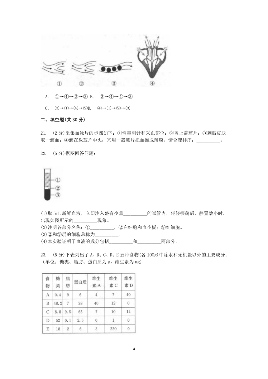 【单元检测】2022-2023学年上学期浙教版九年级科学卷（十三）第四章  代谢与平衡(综合A)【word，含答案】