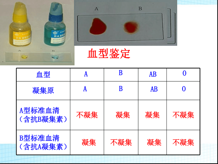 2020-2021学年人教版生物七年级下册4.4.4  输血与血型  课件 （15张PPT）