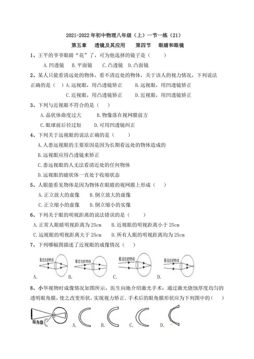 2021-2022学年人教版初中物理八年级上册 一节一练（21)  5.4 眼睛和眼镜（含答案）