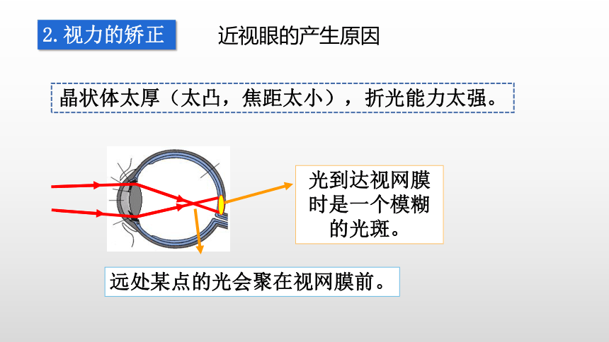 4.6神奇的眼睛—沪科版八年级全一册物理课件(共21张PPT)