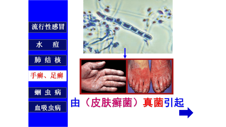 8.1.1+传染病及其预防-2022-2023学年八年级生物下册同步备课优质课件（人教版）(共44张PPT)