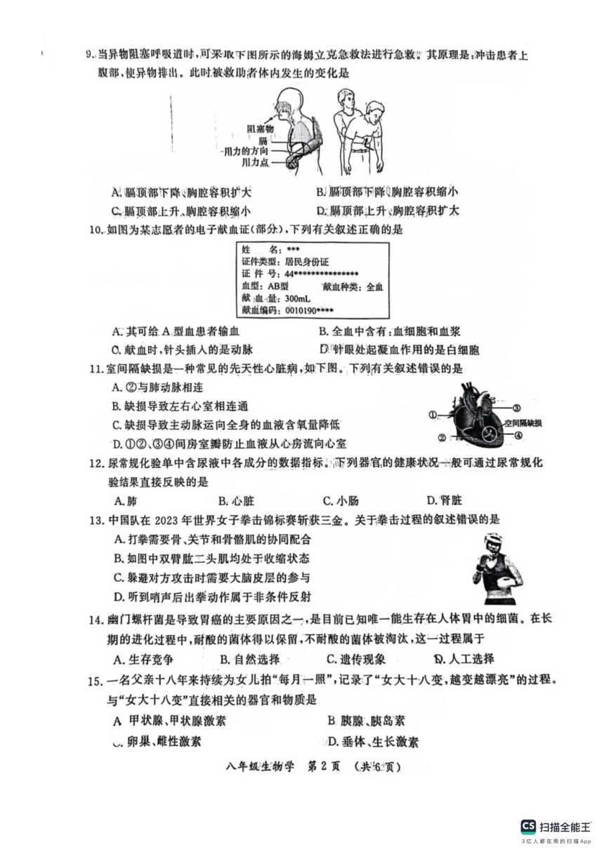2024年河南省开封市中考一模生物试题（pdf版 无答案）