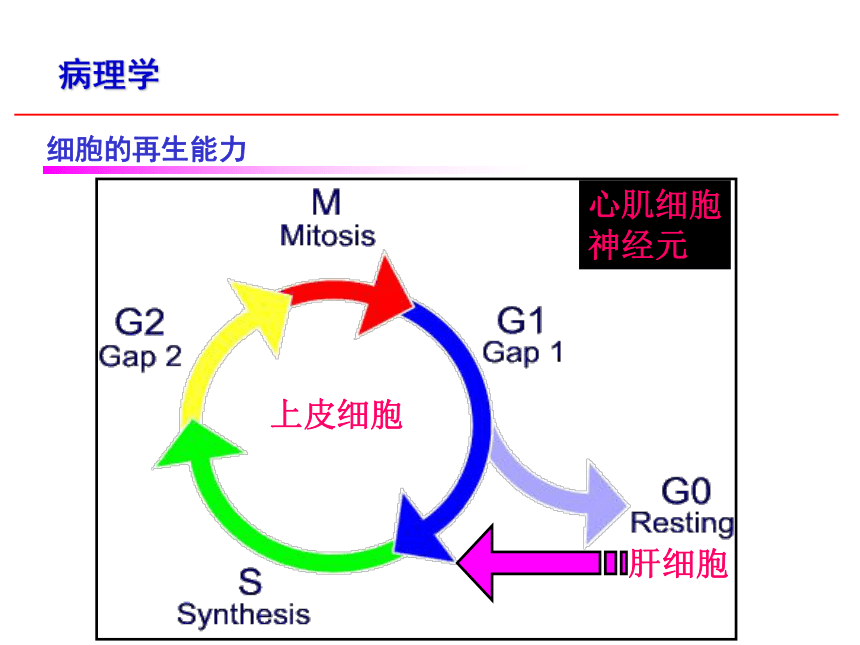 第1章 细胞和组织的适应、损伤与修复3 课件(共27张PPT)-《病理学·第4版》同步教学（科学出版社）