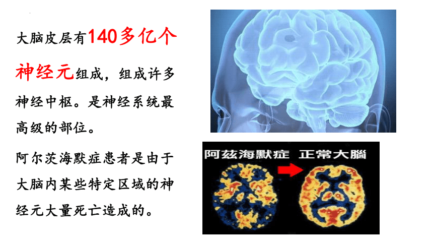 生物人教版2019选择性必修1 2.5 人脑的高级功能（共22张ppt）