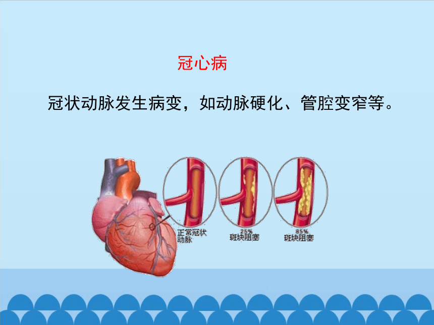 济南版生物七年级下册 第三章 第四节 关注心血管健康课件(共33张PPT)