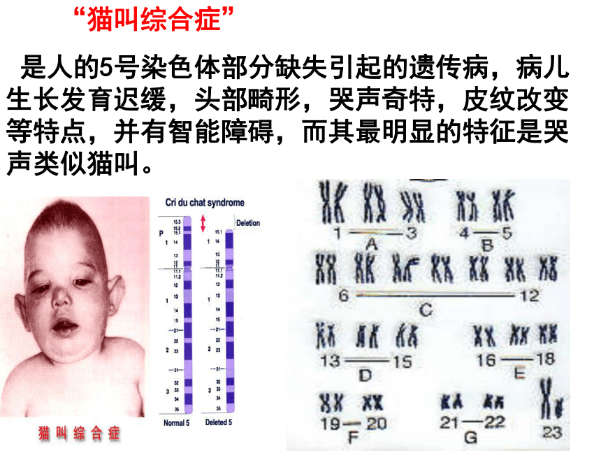 2020-2021学年高一生物人教版必修二5.2染色体变异课件（45张）