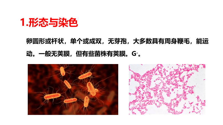 2.5大肠杆菌病 课件(共41张PPT)-《畜禽疫病防治》同步教学（高教版）