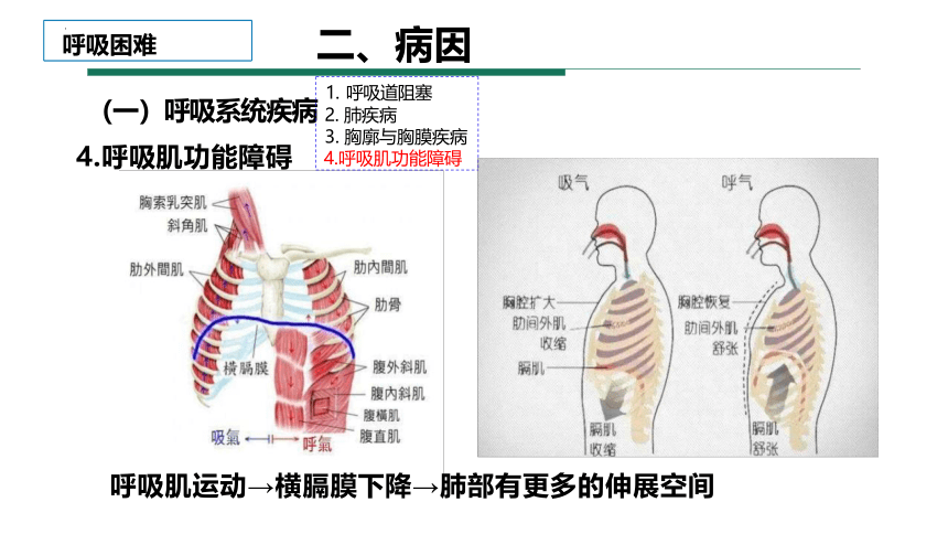 第一篇 常见症状 呼吸困难课件(共55张PPT)《诊断学基础》同步教学（人卫版）