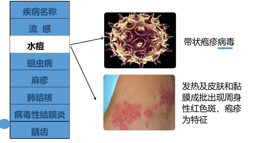 8.1.1传染病及其预防课件（共31张PPT） 人教版生物八年级下册