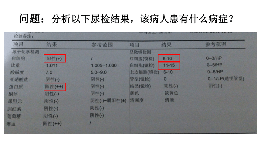 7.2 尿液的形成和排出 课件 (共26张PPT)京改版生物七年级下册