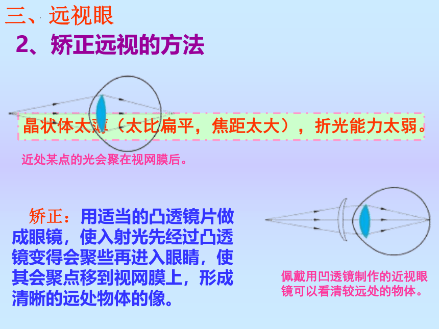 第六章第四节《眼睛和眼镜》课件2021-2022学年北师大版八年级物理下册(共21张PPT)