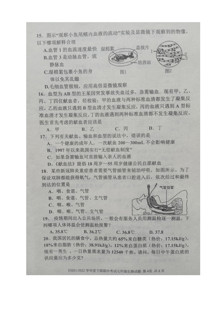 河南省周口市扶沟县2021-2022学年七年级下学期期中考试生物试卷（图片版 有答案）