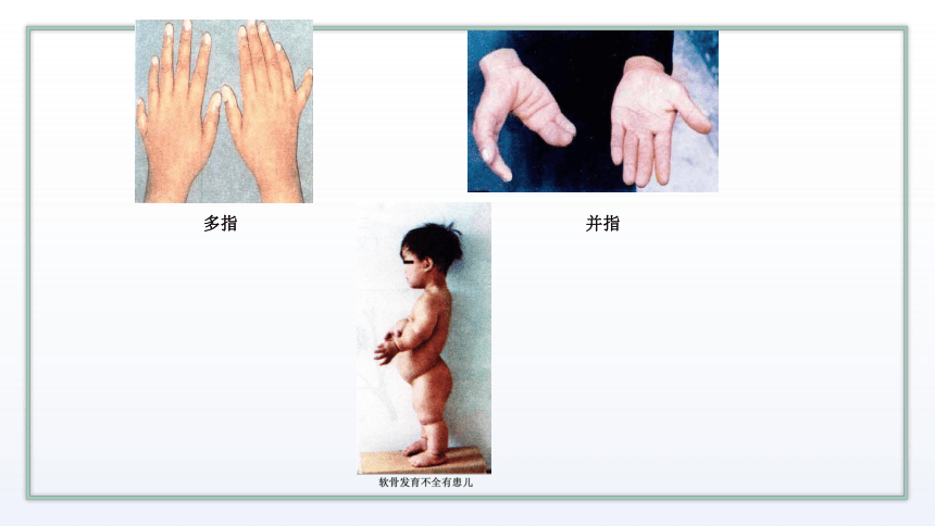 高中生物新苏教版必修二3.3 关注人类遗传病 课件 (共18张PPT)