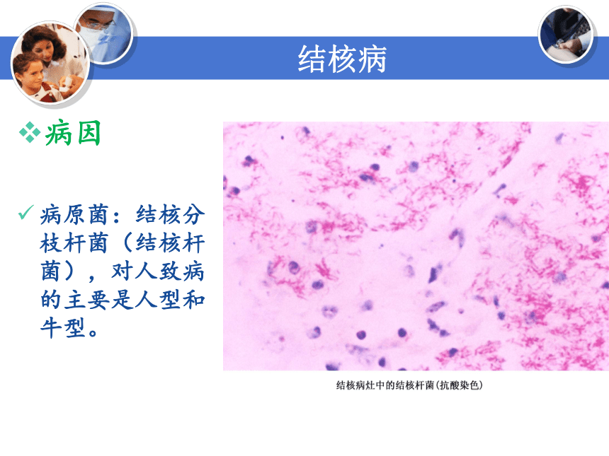 3.6.2结核病 课件(共41张PPT)-《病理学基础》同步教学（人卫版）