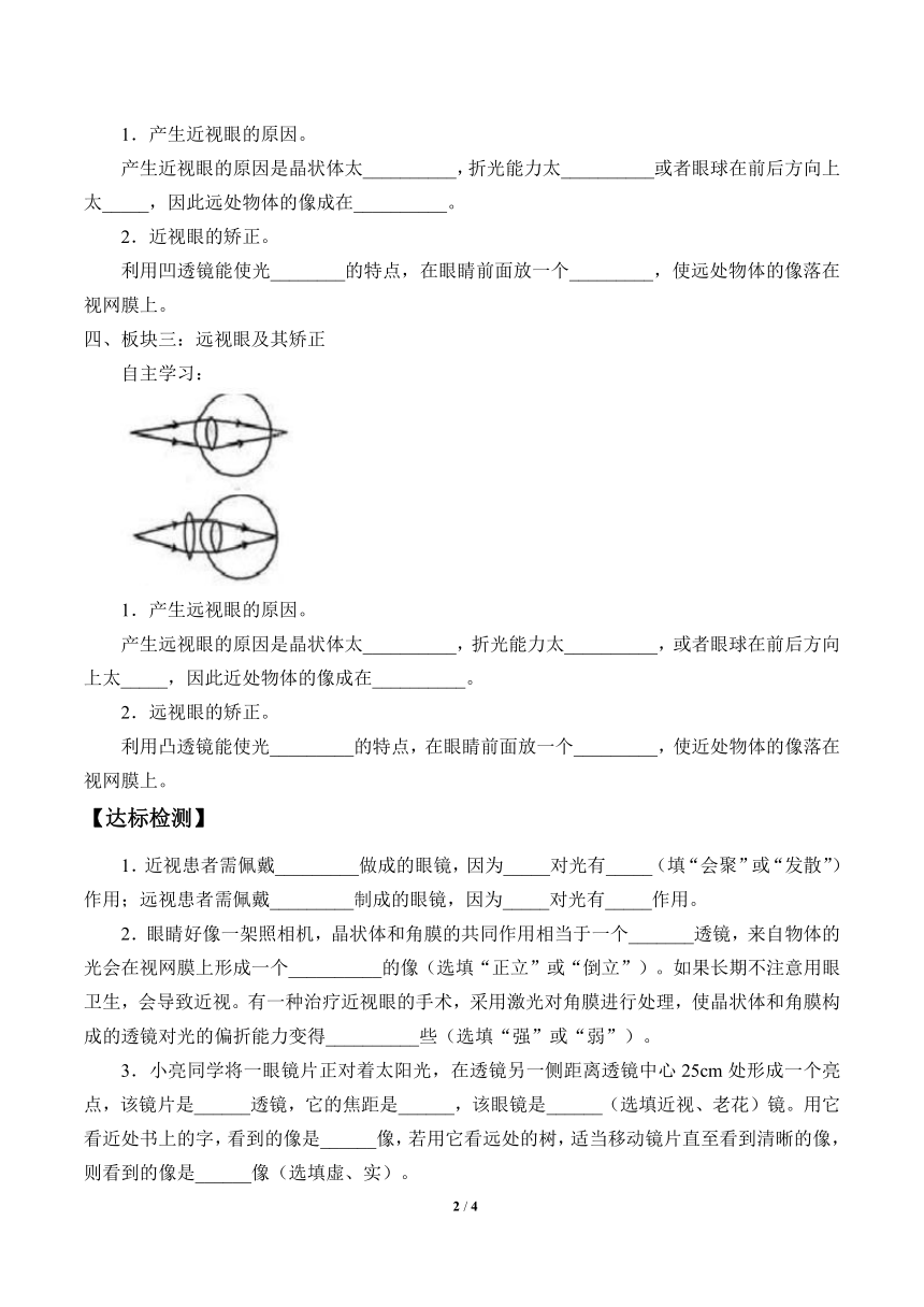 鲁教版（五四制）八年级上册 物理 学案 4.4眼睛和眼镜（无答案）