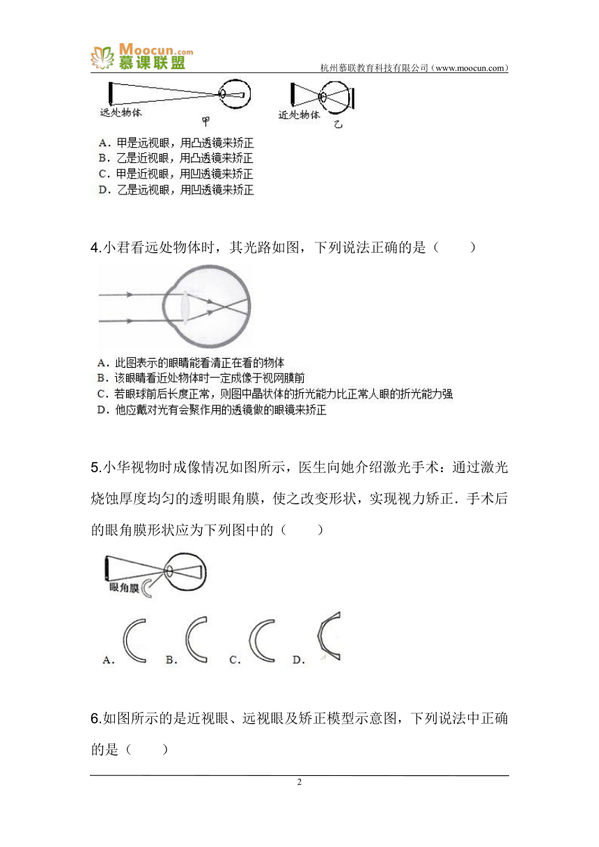 人教版初中物理八年级上册第五章第四节5.4眼睛与眼镜（同步练习）含答案