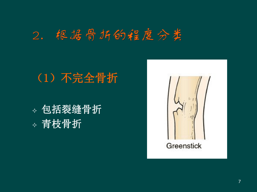 骨折后的康复 课件(共76张PPT)