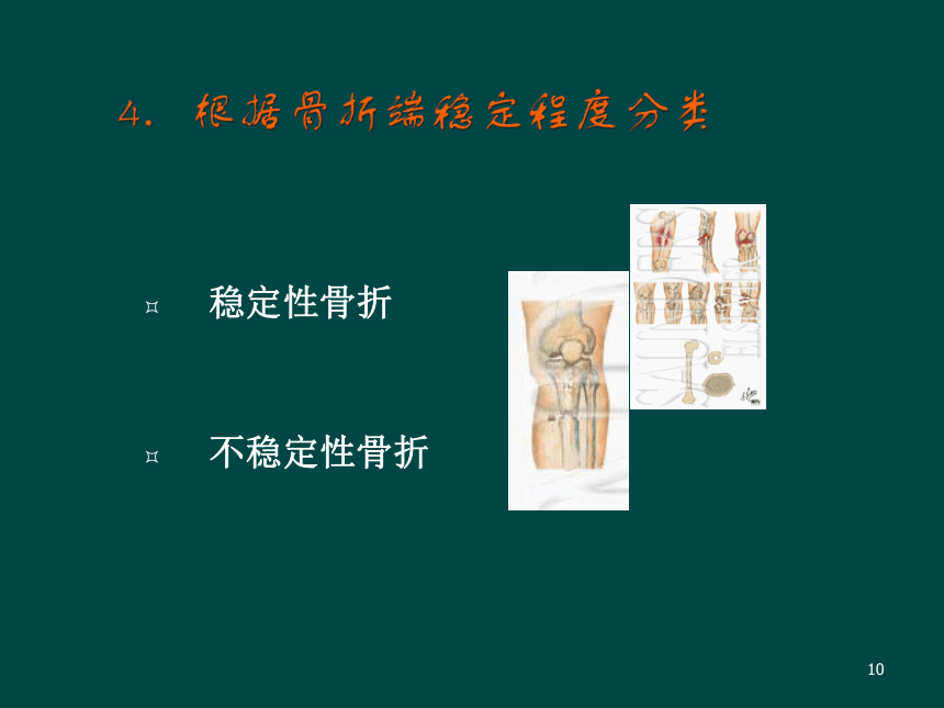 骨折后的康复 课件(共76张PPT)