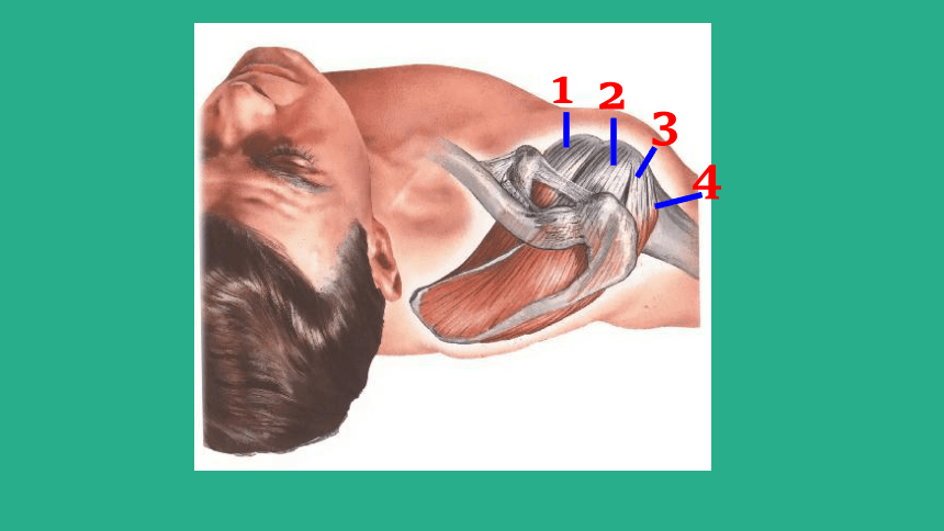 肩袖损伤基本康复治疗 课件(共41张PPT)