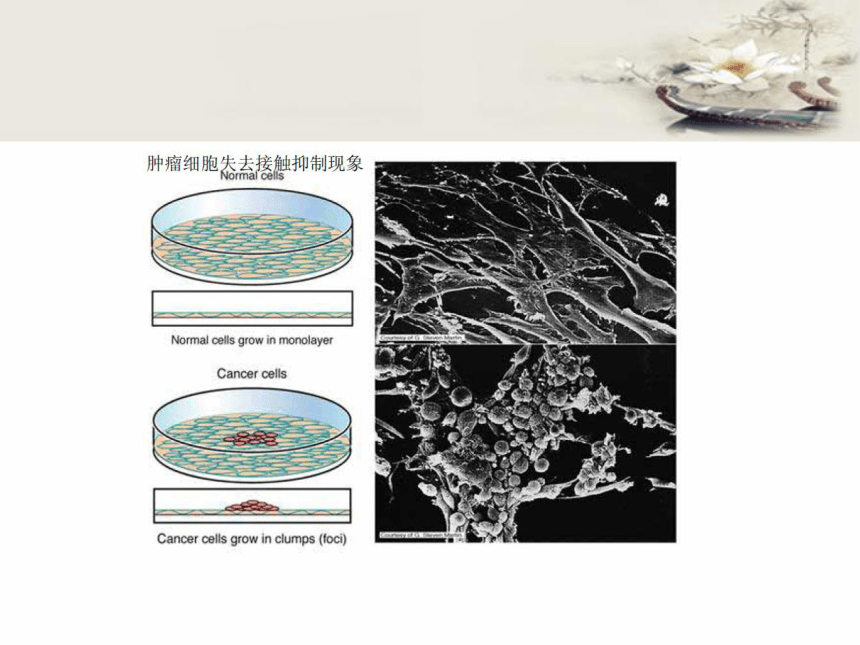 2020-2021学年高中生物竞赛动物细胞工程第三节 肿瘤细胞的培养课件（共31张PPT）