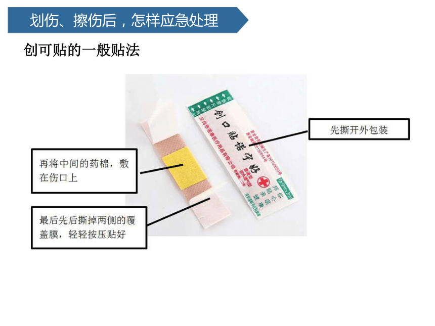 青岛版（六三制2017秋） 五年级上册15.划伤、擦伤怎么办课件（17张PPT )