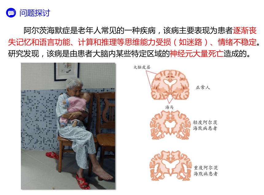 2.5人脑的高级功能-(共25张PPT2份视频)课件人教版2019选择性必修1