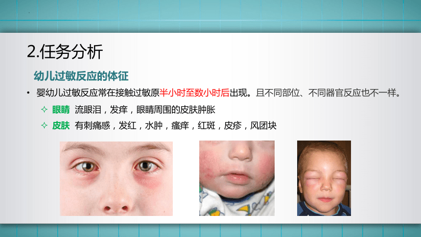 7.模块二任务4 过敏反应的应急处理与预防 课件(共40张PPT)华师大版