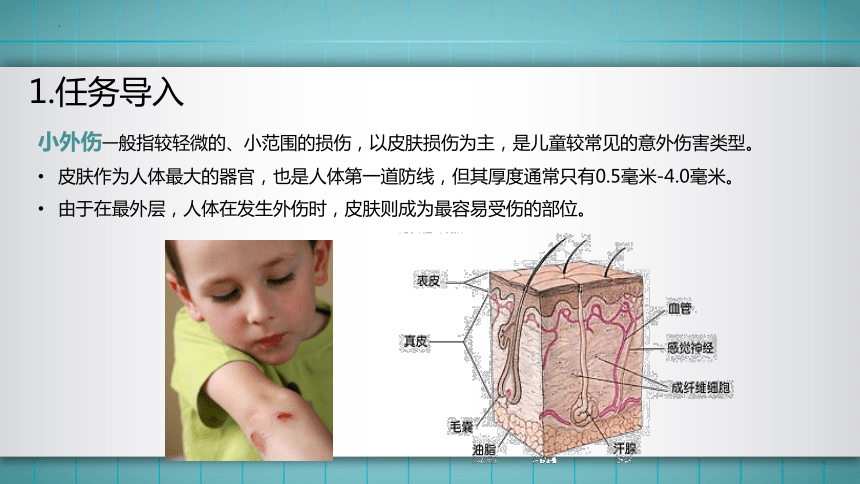 14.模块三任务4 小外伤的应急处理与预防 课件(共53张PPT)华师大版